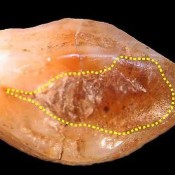 Beeswax Filling May Be Oldest Hint of Dentistry