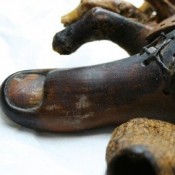 The world’s oldest prosthetics