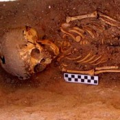 Earliest Case of Child Abuse Discovered