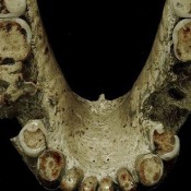 ‘Ancient humans’ used toothpicks