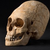 Deformed, Pointy Skull from Dark Ages Unearthed in Alsace