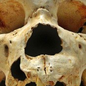 DNA From A 400,000 Hominin: a Great Leap Forward
