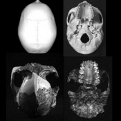 Homo’s Brain Growth Inversely Proportional to Tooth Growth