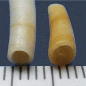 Shell beads from the Mediterranean in Bronze Age Britain?