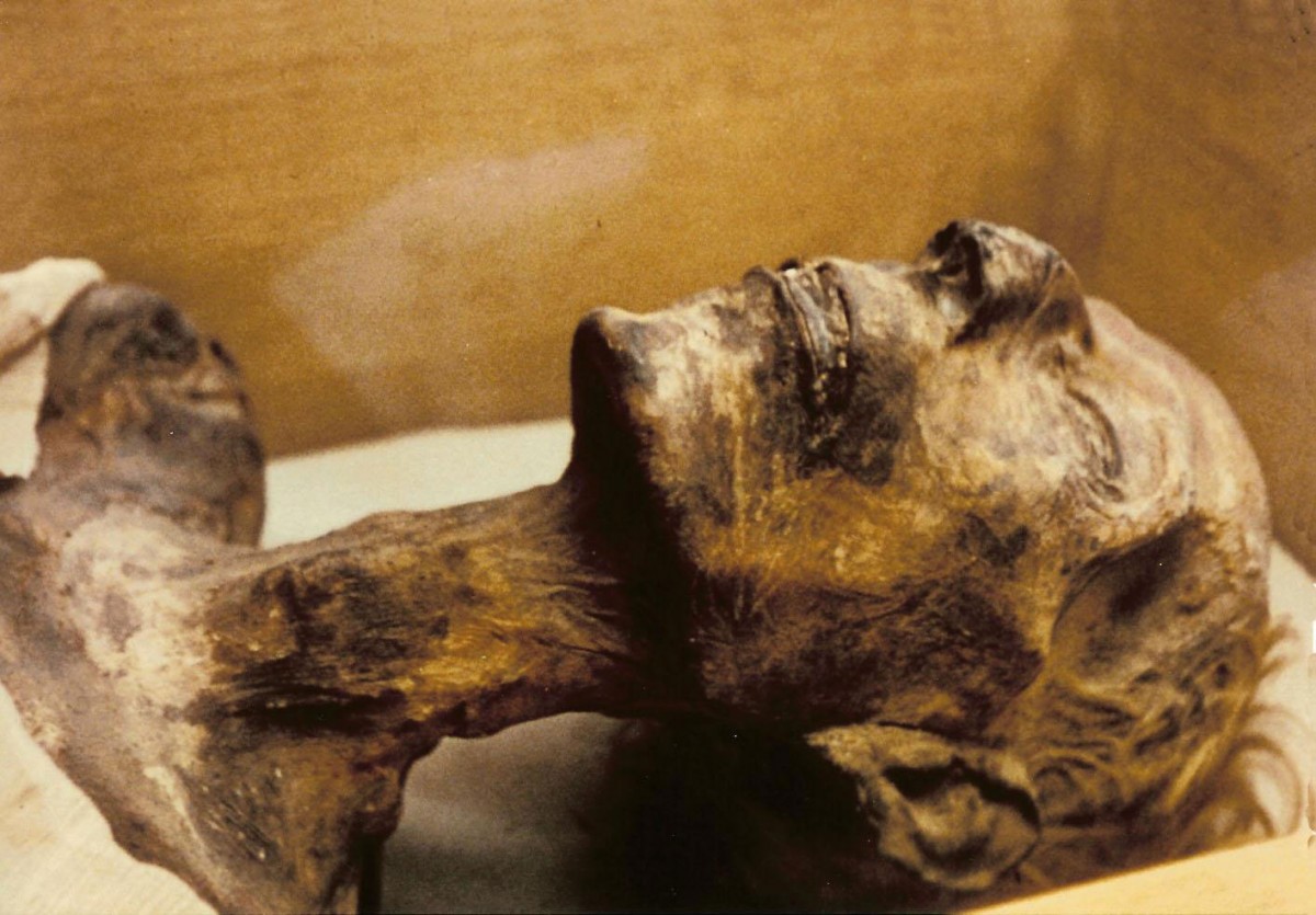Mummy of King Rameses II.