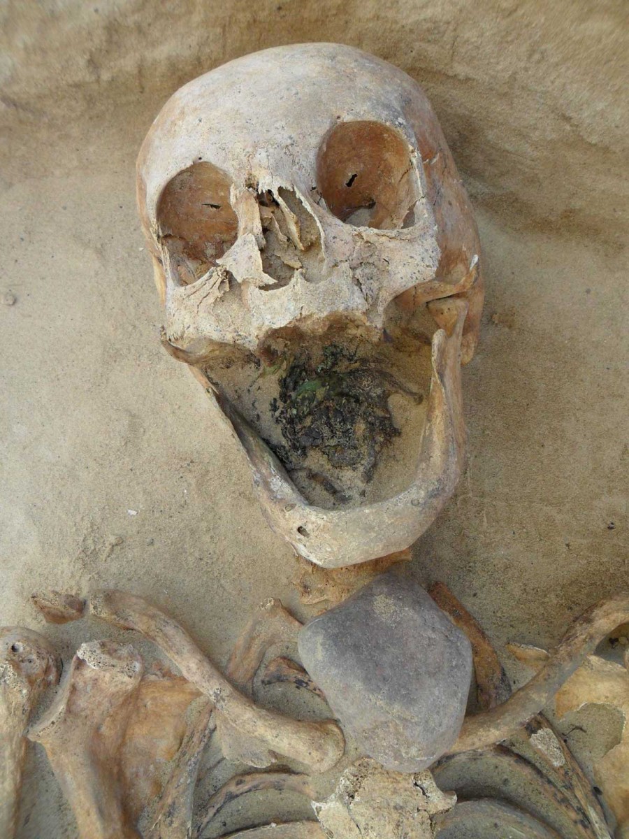 Individual 60/2010 (45-49 year old female) is shown with a stone placed directly on top of the throat. Credit: Gregoricka et al.