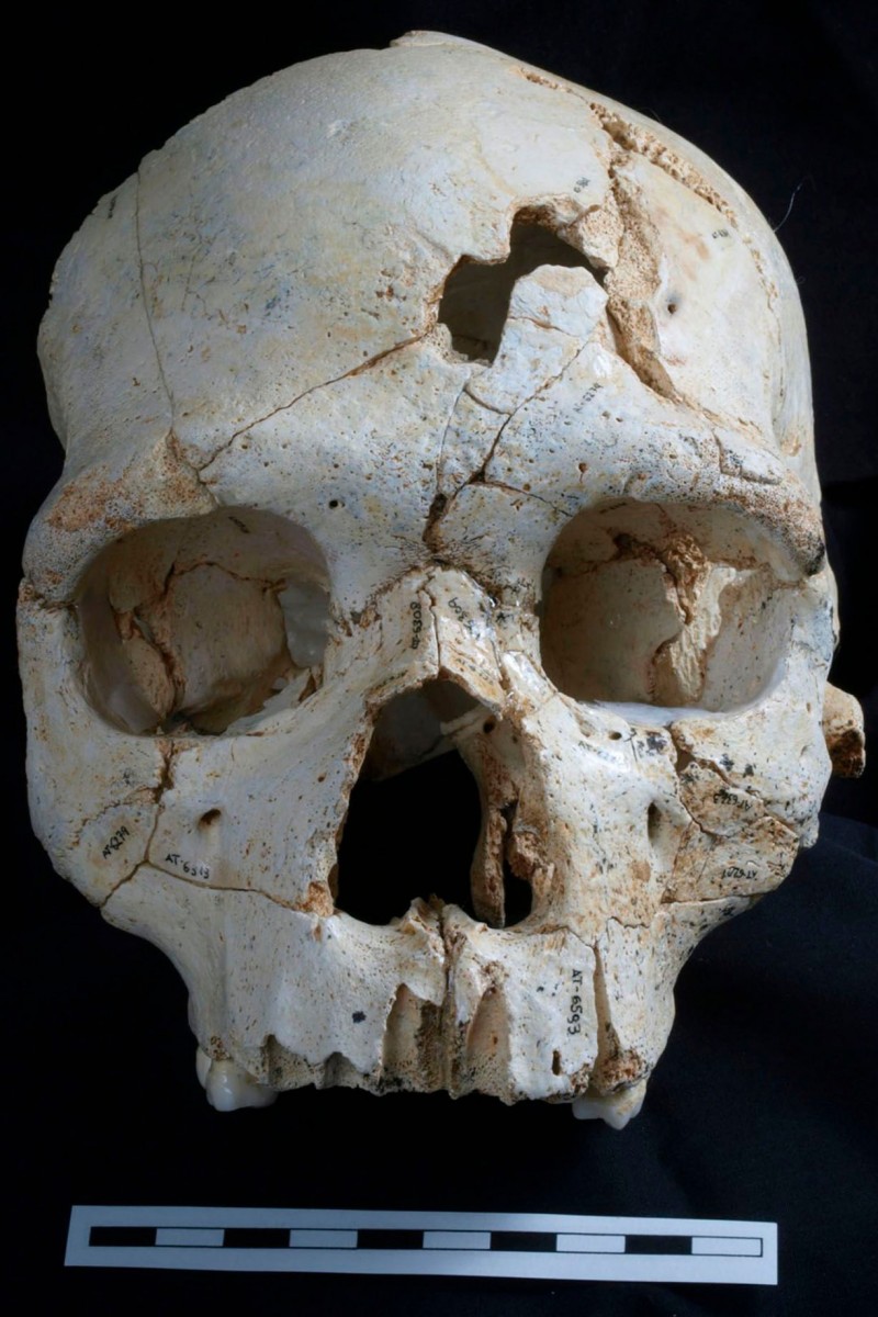 Pieced together from 52 fragments, the skull has two puncture wounds above its left eye, suggesting the victim was bludgeoned to death. Photo Credit: The Guardian / PR