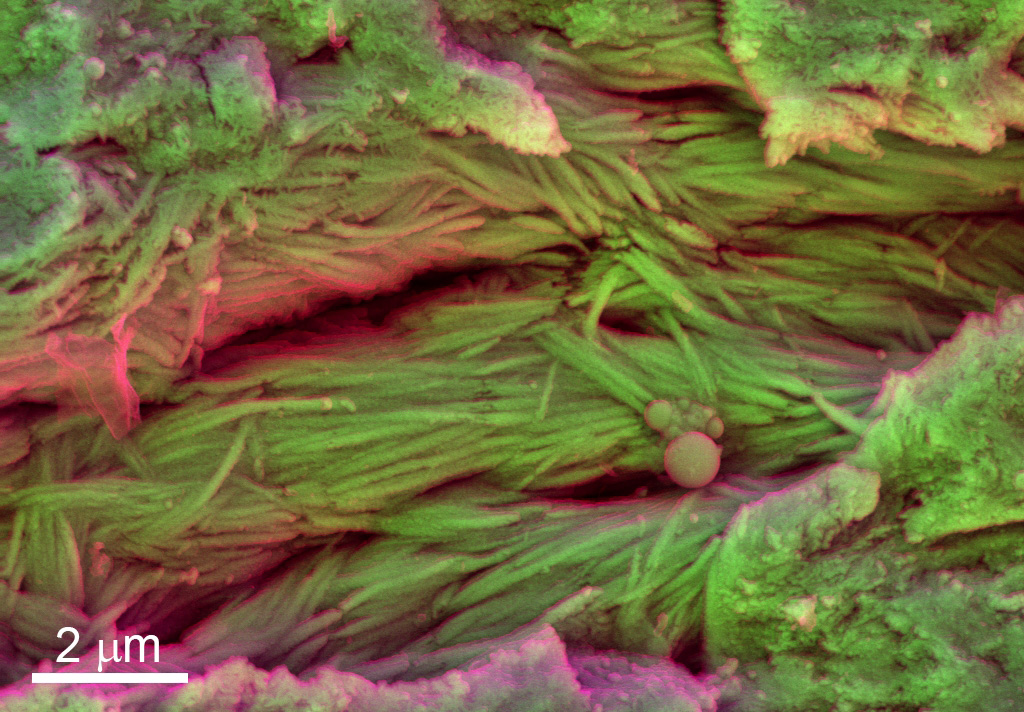 This colorized electron micrograph image shows mineralized fibers from the ribs of an unidentified Cretaceous dinosaur. (Credit: Sergio Bertazzo)
