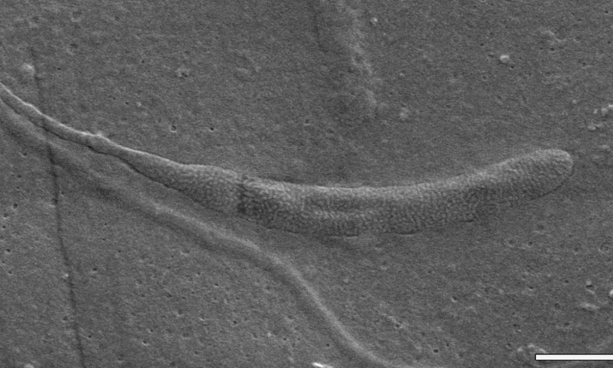 A fragment of the the fossilized spermatozoon. The bar at the bottom, one micron long, offers scaling. Photo Credit: Swedish Museum of Natural History / The Guardian. 