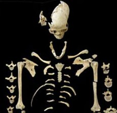This approximately 7,000-year-old female skeleton revealed signs of leukemia. © M. Francken/Universität Tübingen