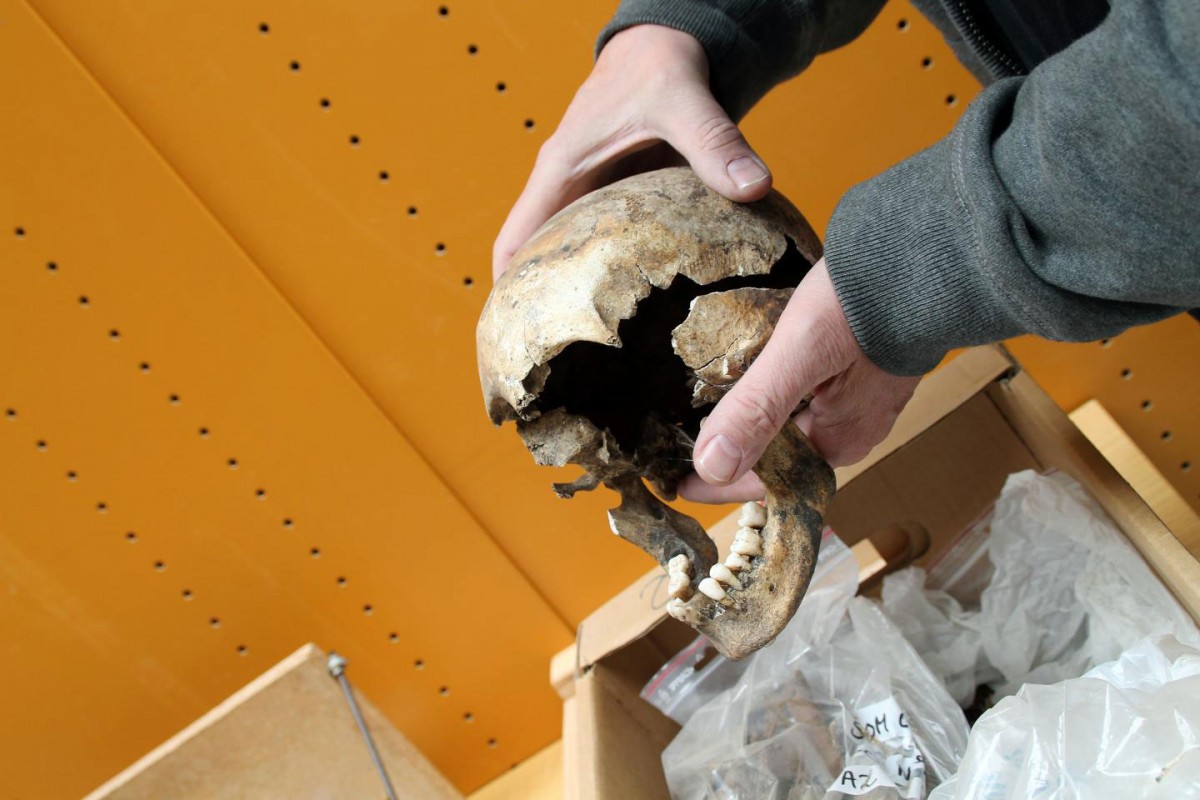 Skull of young girl suffering from syphilis.
Credit: Birgitte Svennevig/SDU