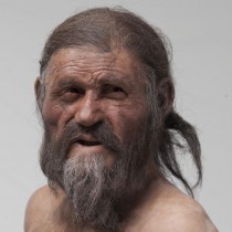 Pathogens found in Ötzi’s stomach