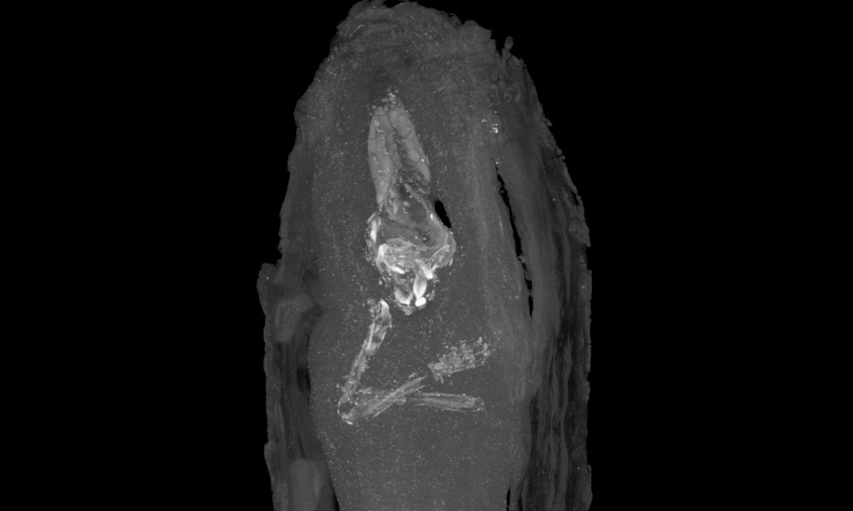 The Fitzwilliam foetus. Credit: the Fitzwilliam Museum, Cambridge