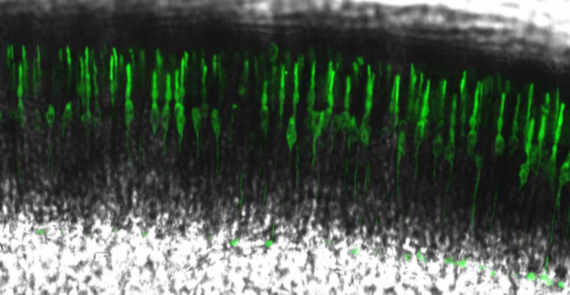 This image shows cone photoreceptors (green) in a slice from a mouse retina. A majority of the photoreceptors (97%) in the retina are rods (black). The black layer on top of the photoreceptors is retinal pigment epithelium.
Credit: Jung-Woong Kim