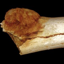 Cancer on a Paleo-diet?