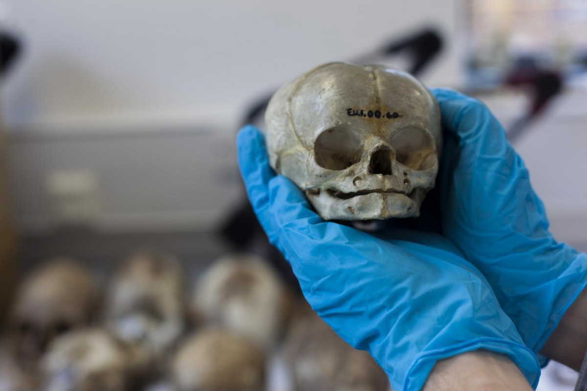 Dissected fetal skull dating from the 1800s, originally held in the University of Cambridge Anatomy Museum.
Credit: Nick Saffell
