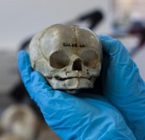 Infant bodies were ‘prized’ by 19th century anatomists, study suggests