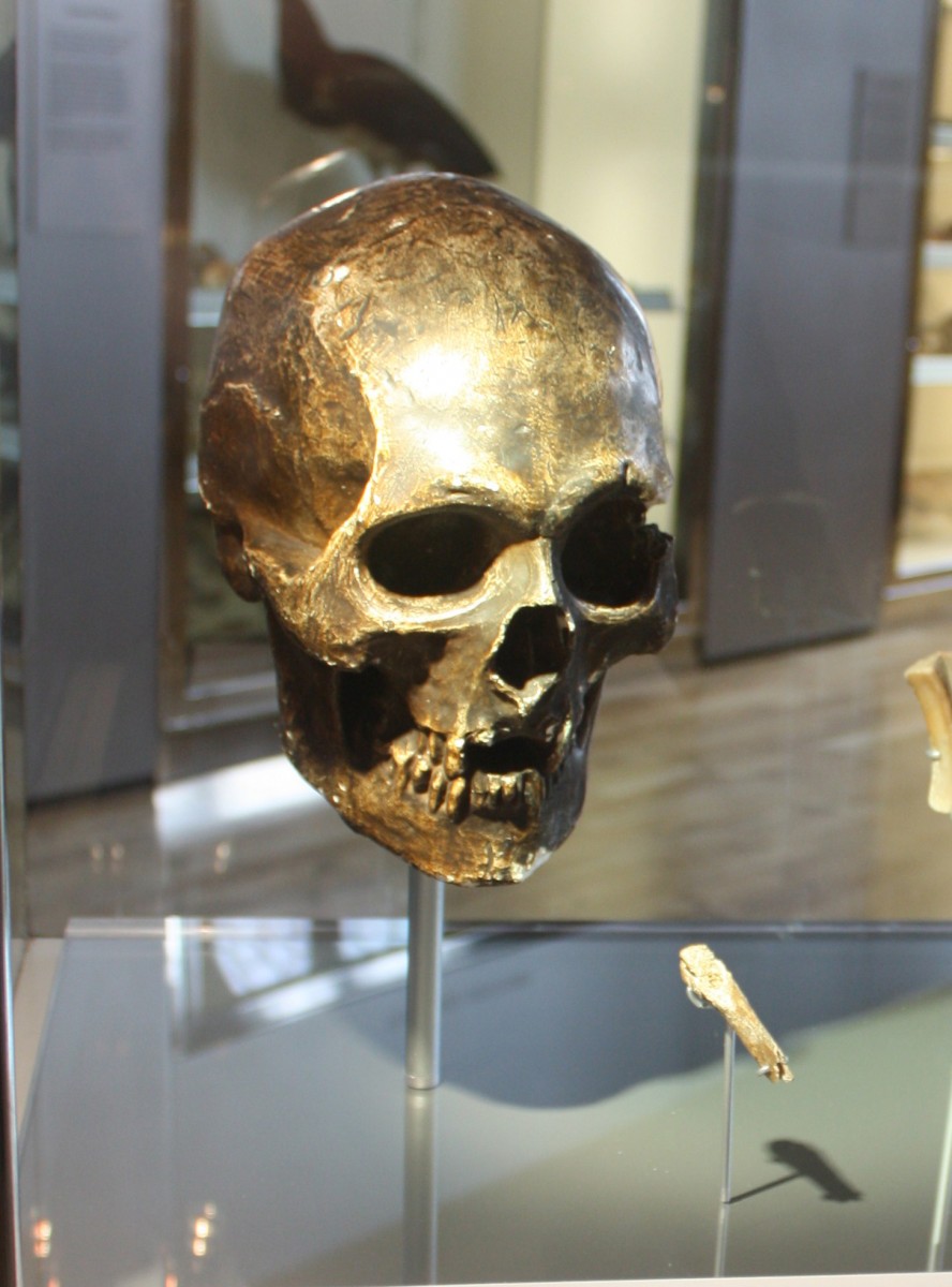 Skull cast of Robert the Bruce at the Hunterian Museum. 