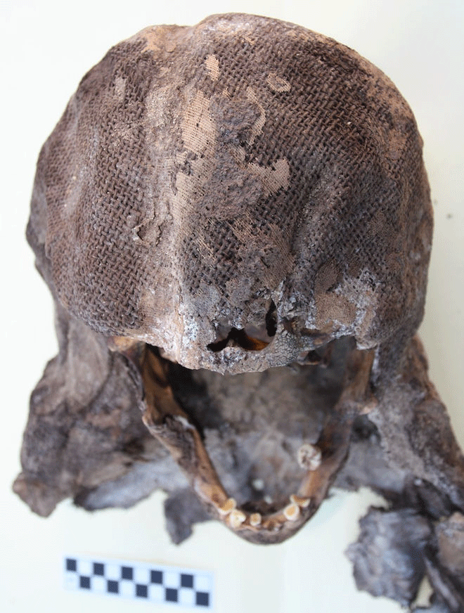 Some of the individuals buried near al-Ghazali were found with burial shrouds. The shroud of this person still covers their skull. Photo Credit: LiveScience/Robert Stark.