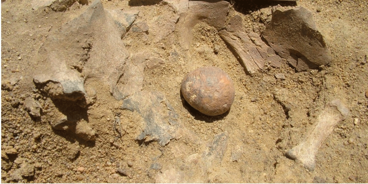 The stones, as large as walnuts, were found in 2013 in the pelvic area of an adult male in a cemetery of central Sudan. Photo Credit: Centre for Sudanese and sub-Saharan Studies, Treviso/Università di Padova.