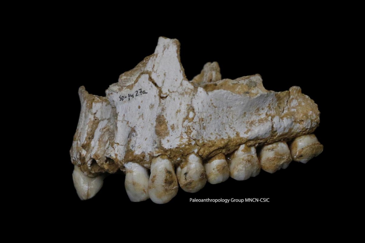 El Sidron upper jaw: a dental calculus deposit is visible on the rear molar (right) of this Neandertal. This individual was eating poplar, a source of aspirin, and had also consumed moulded vegetation including Penicillium fungus, source of a natural antibiotic. Image credit: Paleoanthropology Group MNCN-CSIC
