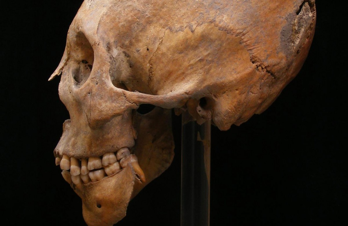 A modified skull from Gyõr. The practice of modification originated in Central Asia and has been associated with Huns and other nomadic populations. Credit: Erzsébet Fóthi, Hungarian Natural History Museum Budapest.