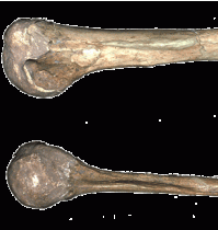 Neanderthal injury patterns cannot be compared to modern ones