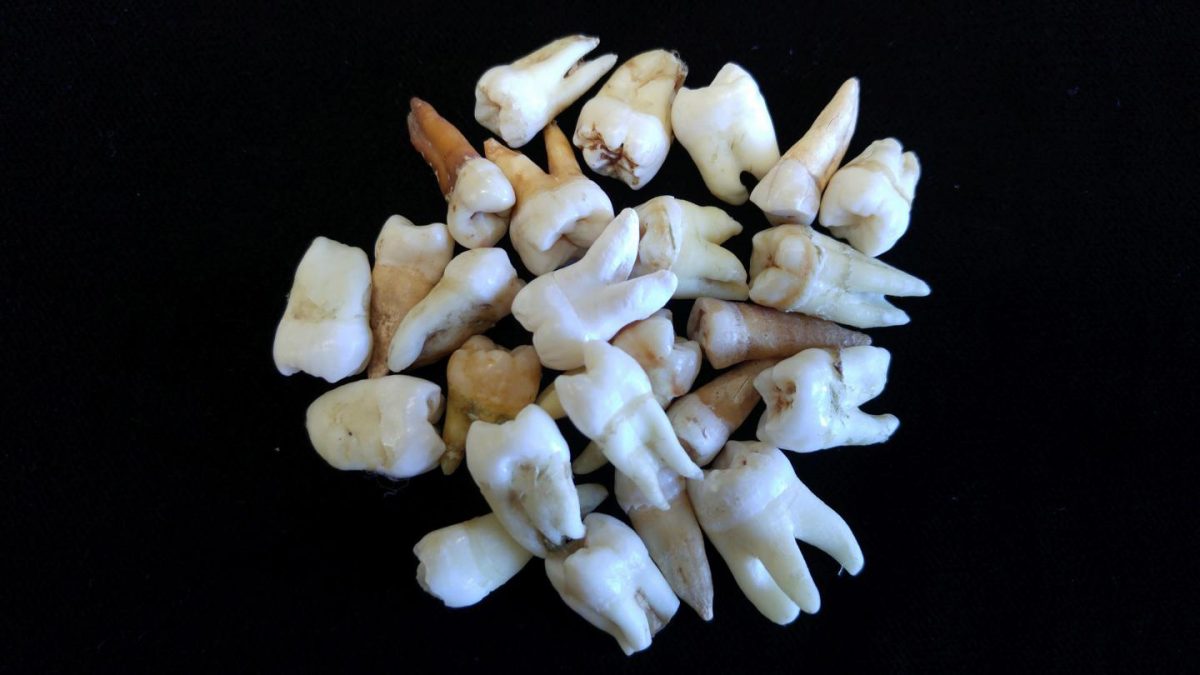 These are teeth from Megan Brickley's lab at McMaster University.
Credit: McMaster University