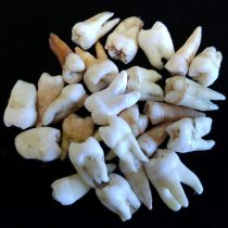 Tooth truth