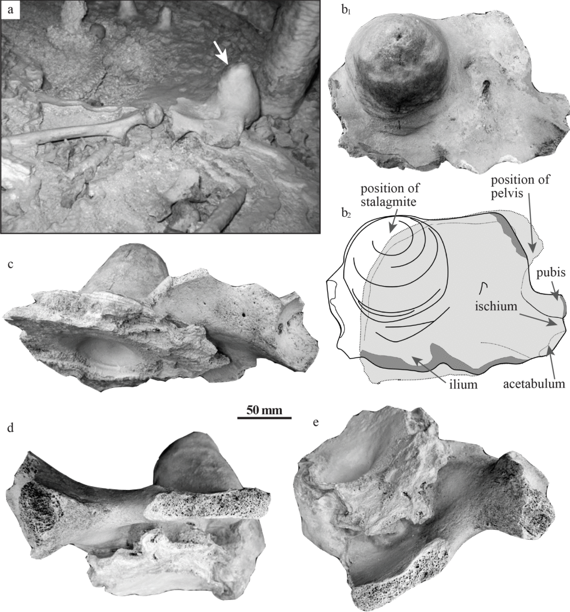 The Chan Hol II pelvis.
Different views of the Chan Hol II pelvis within the CH-7 stalagmite. Arrow in Fig 3A points to the CH-7 stalagmite prior to the robbery of the skeleton. Note that the pelvis was then articulated to the right femur. Extraction of collagen and thus 14C age determination failed on the bones of the Chan Hol II individual due to the complete dissolution of organic matter, specifically collagen. Photo Credit: PLOS ONE.