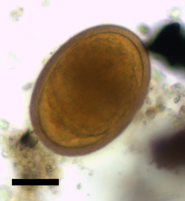 Roundworm egg taken from faeces excavated at Kea. Credit: Piers Mitchell/Elsevier