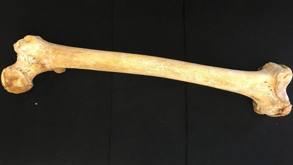 Forensic researchers at North Carolina State University have found a more accurate way to assess an individual's age at death, based on the bone mineral density of the femur. The technique could be used to help identify human remains. Credit: Matt Shipman