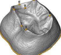 First 3D morphometric study of the molars of Sima de los Huesos