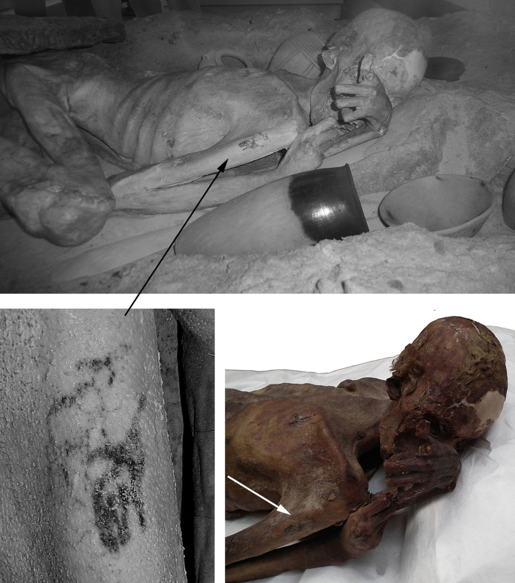 Top: Infrared image of the male mummy known as Gebelein Man A. Lower left: Detail of the
tattoos observed on his right arm under infrared light. Lower right: The mummy and tattoos under normal lighting conditions.
