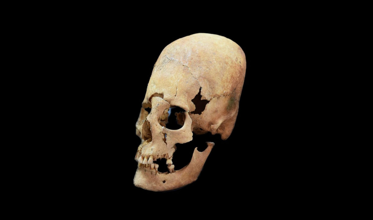 This is an artificially deformed female skull from Altenerding, an early Medieval site in Bavaria. Image credit: State Collection for Anthropology and Palaeoanatomy Munich. 