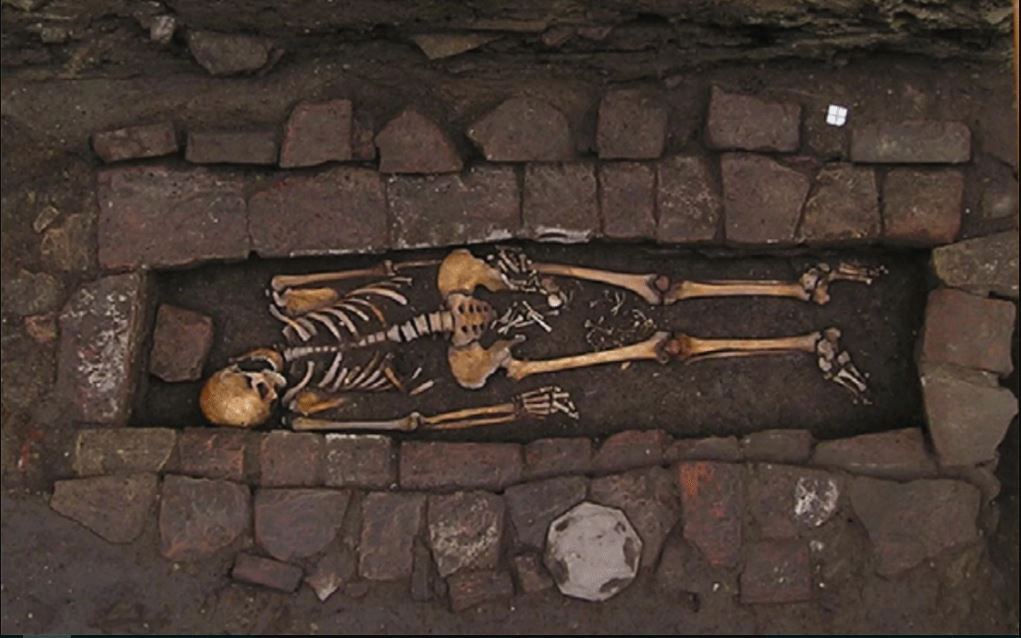 A mysterious, medieval skeleton discovered in Italy shows signs of a coffin birth and primitive brain surgery. Photo Credit: Pasini et al./World Neurosurgery/Elsevier/Live Science.