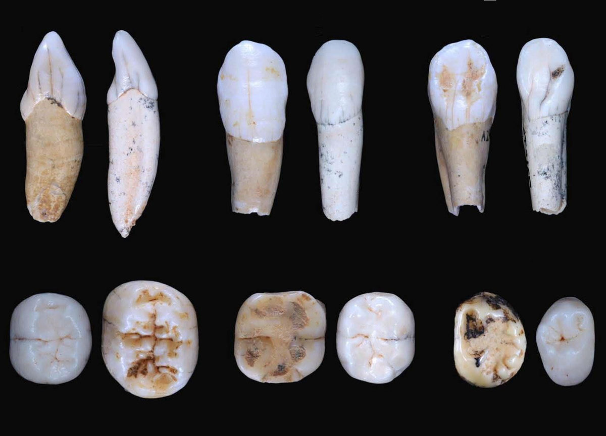 Dental sample/Mario Modesto.