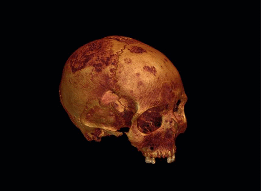 A rendering of the ancient skull created from CT scans.
Credit: Courtesy Roberto Miccichè, Giuseppe Carotenuto & Luca Sìneo  for LiveScience.
