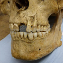 Research on British teeth unlocks potential for new insights into ancient diets