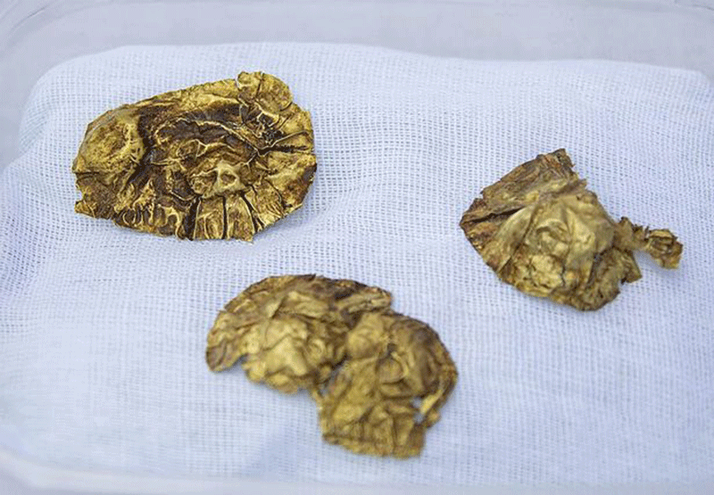Among the finds are earrings in the shape of bells, gold plates with rivets, plaques, chains, and a necklace with precious stones. Photo Credit: East-Kazakhstan region/east2west / Mirror. 