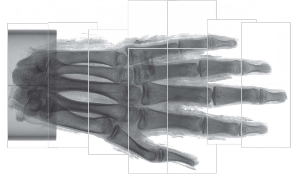 Here, the field of view for each scan is shown. Before tomographic reconstruction, the left regions of the fourth and fifth scan from the bottom were stitched together with their respective right counterpart. The scale shows centimeters. Credit: Radiological Society of North America