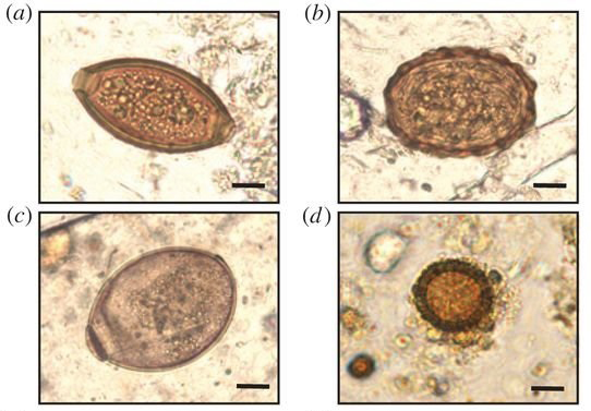 Identification and enumeration of helminth eggs in Lübeck deposits reveal a temporal pattern of cestode infections.
Micrographs of parasite eggs in archaeological samples from Lübeck (a–d), images of eggs in Lübeck samples are
representative of those detected in other sites. Trichuris spp. (a), Ascaris spp. (b), Diphyllobothrium spp.
(c), and Taenia spp. (d) Scale bar: 10 µm. Credit: Patrik G. Flammer et al. 2018