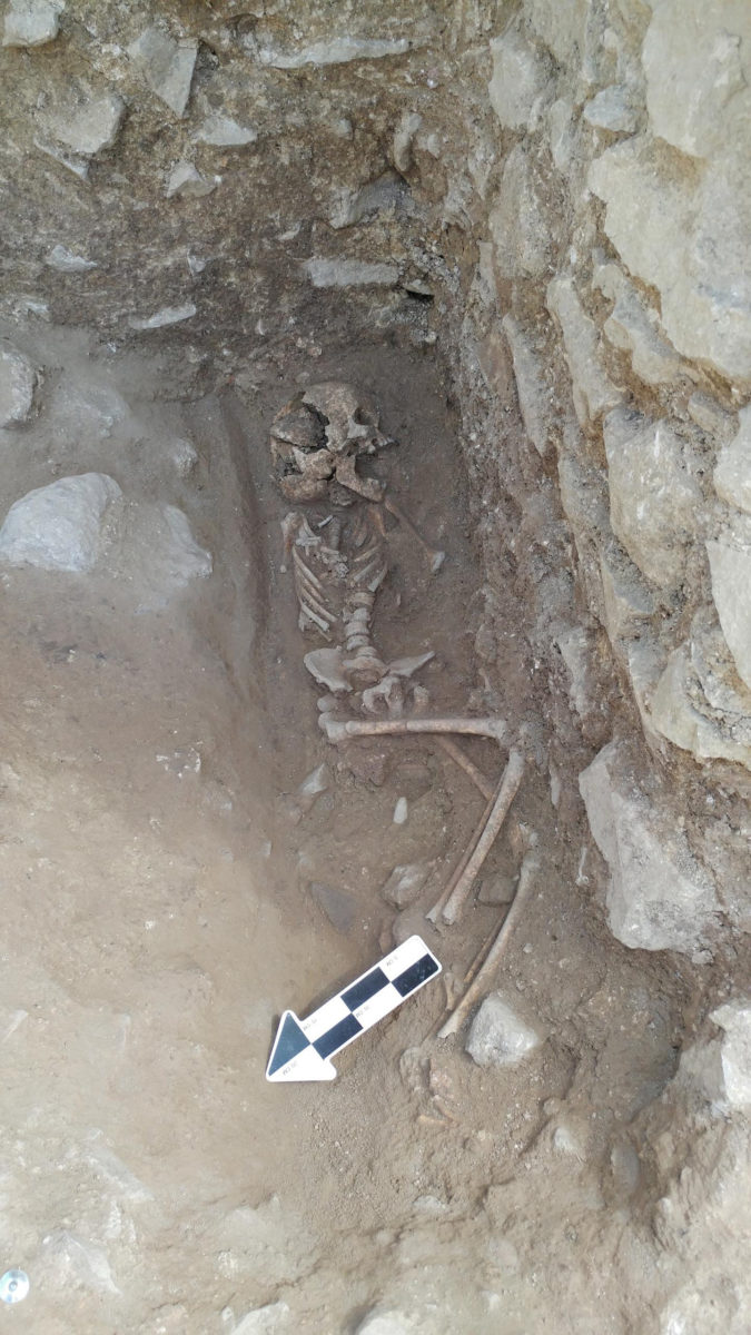 A 10-year-old was discovered lying on its side in a fifth-century Italian cemetery previously believed to be designated for babies, toddlers and unborn fetuses. Credit: Photo courtesy of David Pickel/Stanford University