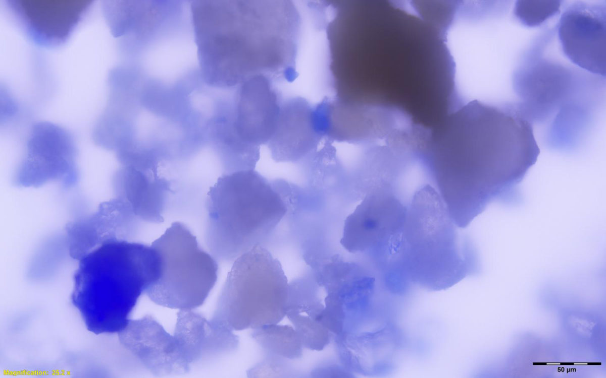 This is a magnified view of lapis lazuli particles embedded within medieval dental calculus.
Credit: Monica Tromp