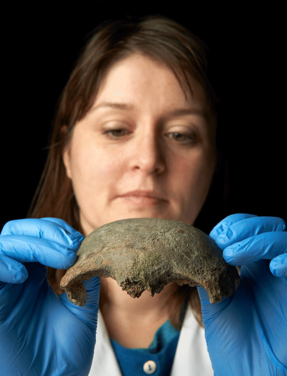 Radiocarbon dating revealed that the person died about 5,600 years ago and was a male over the age of 18. Photo Credit: Museum of London/The Guardian.