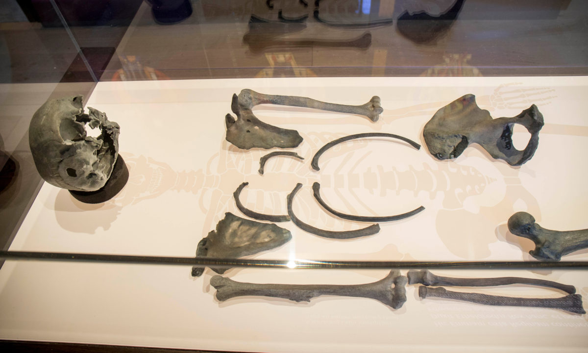 Skeletal remains.