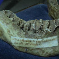 French king Louis IX had severe scurvy study finds