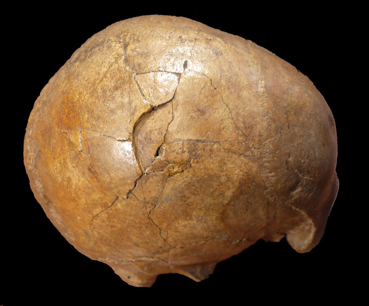 Right lateral view of the Cioclovina calvaria exhibiting a large depressed fracture.
Credit: Kranoti et al, 2019