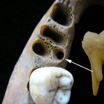 Interbreeding between archaic humans and Homo sapiens in Asia