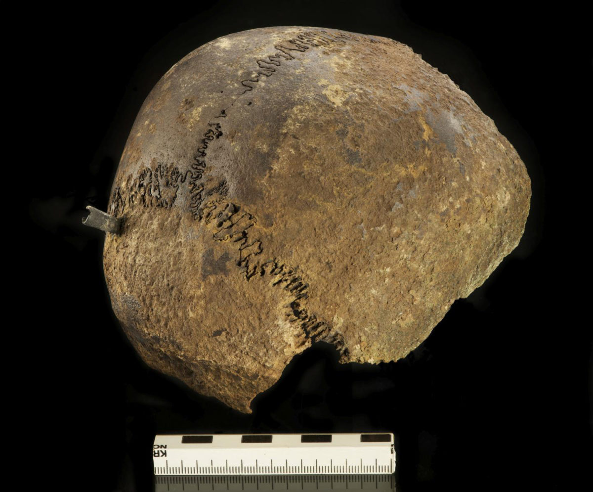 This is a human skull found in the Tollense valley with fatal trauma caused by a Bronze arrowhead. Credit: Volker Minkus